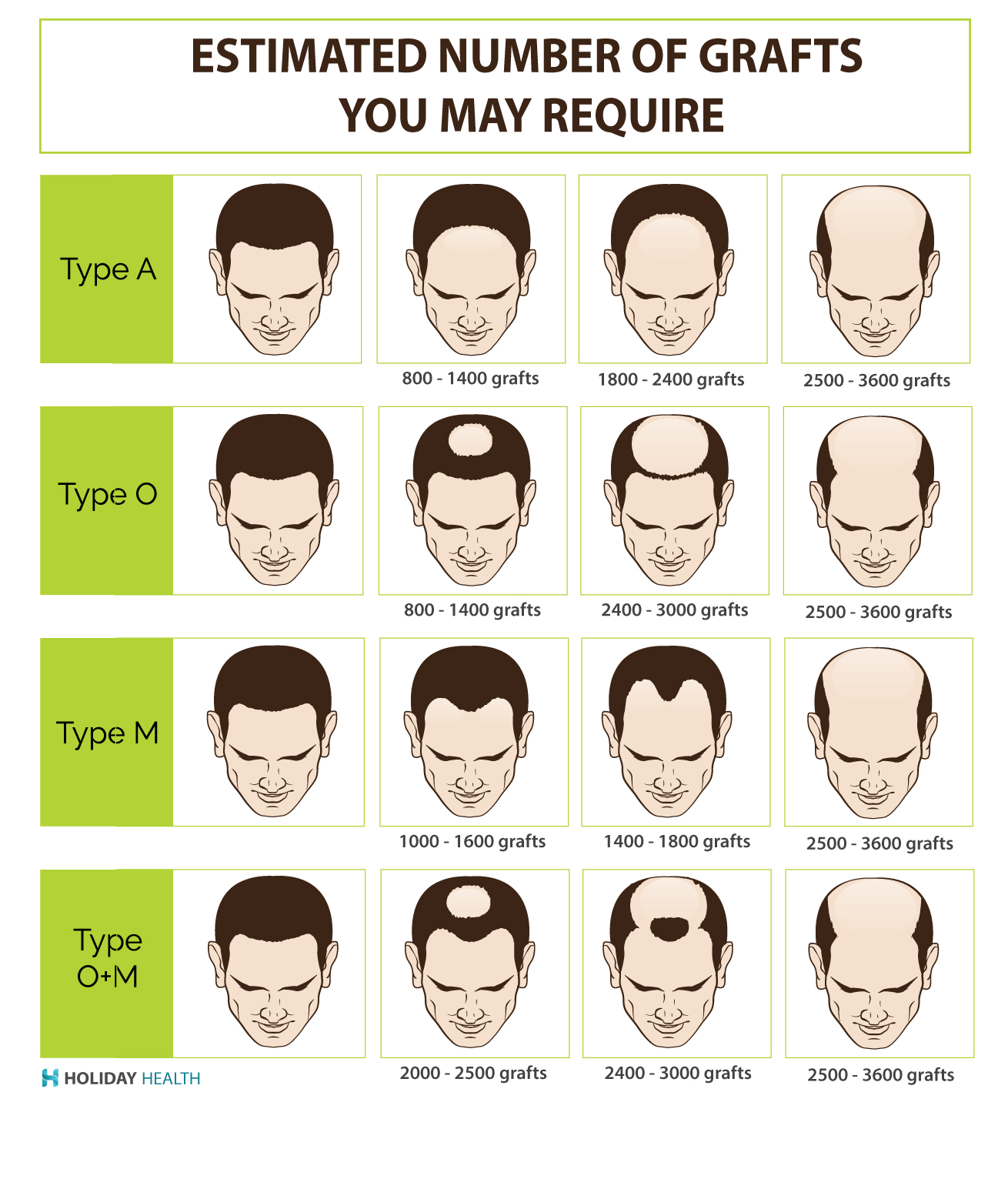 Estimated grafts required for hair transplant