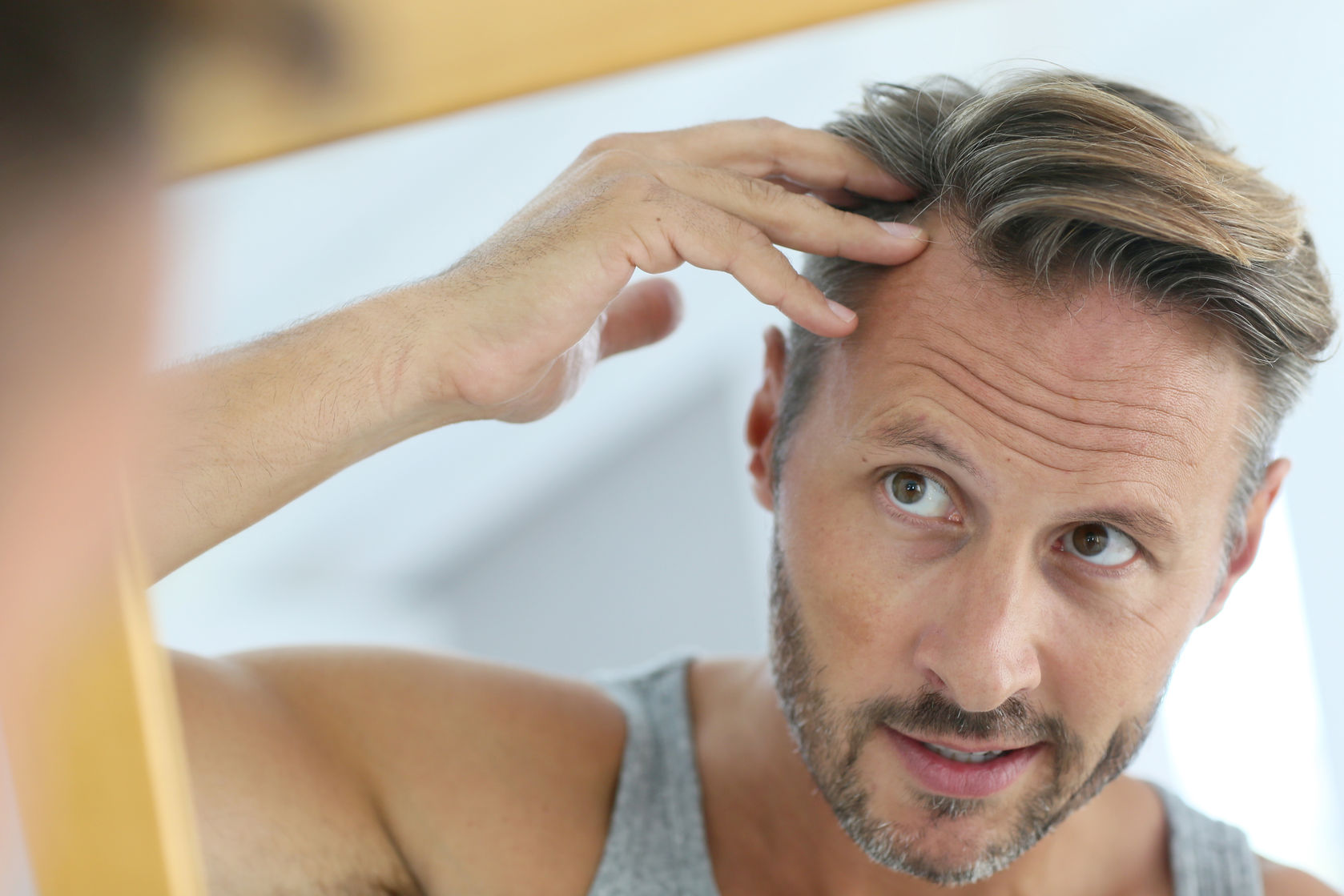 Vitamins and minerals for hair loss prevention